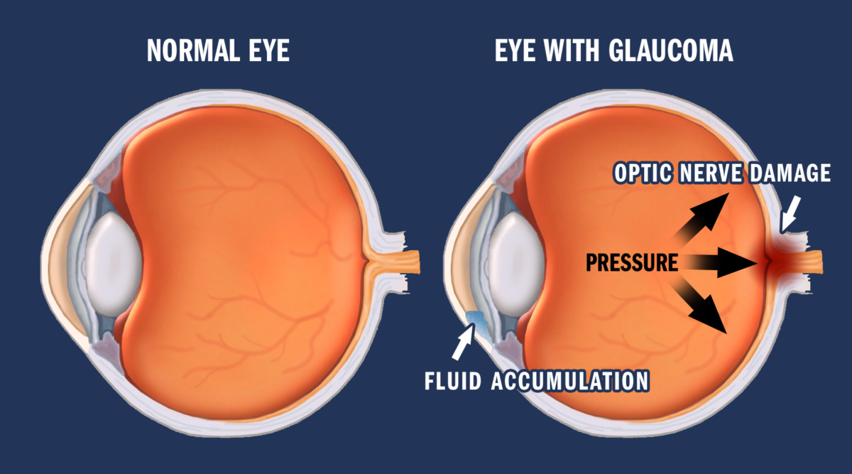 best eye hospital in basti